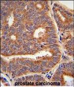 PTPLB Polyclonal Antibody