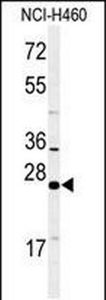 RAB27B Antibody in Western Blot (WB)