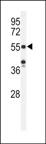 POTEH Antibody in Western Blot (WB)