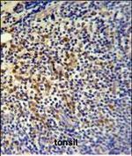 TPPP3 Polyclonal Antibody