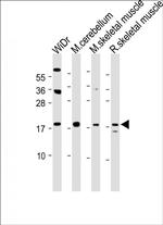 TPPP3 Antibody in Western Blot (WB)