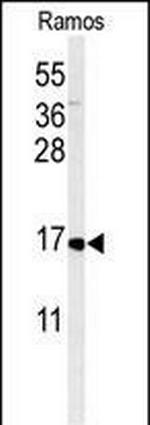 CMTM7 Antibody in Western Blot (WB)