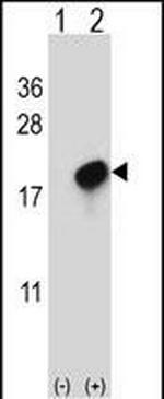 CMTM7 Polyclonal Antibody