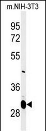 MAGT1 Polyclonal Antibody
