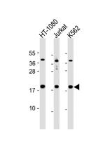 NAT13 Polyclonal Antibody