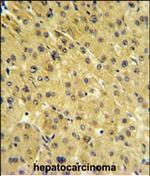 PSMAL Polyclonal Antibody