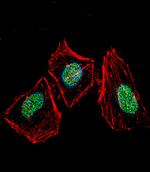 Ku70 Polyclonal Antibody