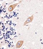 GLD2 Antibody in Immunohistochemistry (Paraffin) (IHC (P))