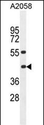 HLA-B Polyclonal Antibody