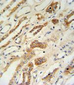 ZFYVE16 Polyclonal Antibody