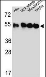 Tubulin beta-2C Antibody in Western Blot (WB)