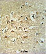 STRIP2 Polyclonal Antibody