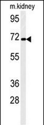 STRIP2 Antibody in Western Blot (WB)