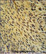 CCDC62 Polyclonal Antibody