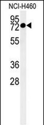 CCDC62 Antibody in Western Blot (WB)