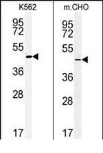 ENTPD8 Antibody in Western Blot (WB)