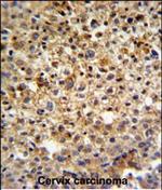 KIAA1529 Polyclonal Antibody