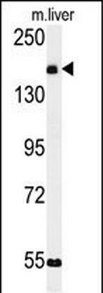 KIAA1529 Antibody in Western Blot (WB)