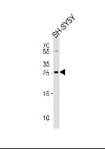 ZDHHC21 Antibody in Western Blot (WB)