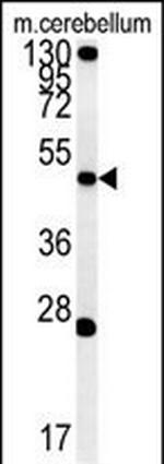 ENPP6 Antibody in Western Blot (WB)