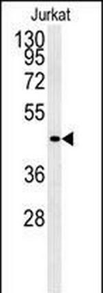 GPR41 Polyclonal Antibody