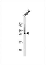 Histone H1.5 Polyclonal Antibody