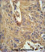 IL5RA Polyclonal Antibody