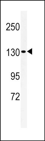 L1TD1 Antibody in Western Blot (WB)