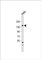 MTMR15 Polyclonal Antibody