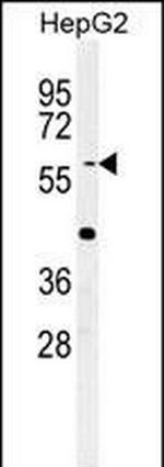 YLAT2 Polyclonal Antibody