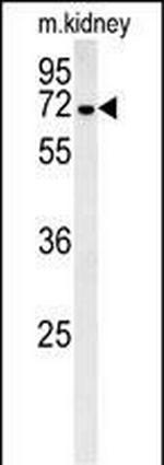 GNE Polyclonal Antibody