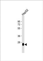 DHRS2 Antibody in Western Blot (WB)