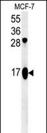 ATP5J2 Antibody in Western Blot (WB)
