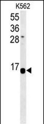 HIST1H2AG Polyclonal Antibody