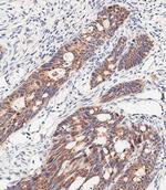 SLC47A1 Polyclonal Antibody