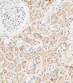 SLC47A1 Antibody in Immunohistochemistry (Paraffin) (IHC (P))