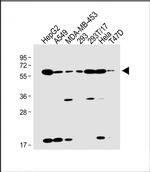 SLC47A1 Antibody in Western Blot (WB)