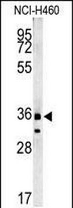 FAM49A Antibody in Western Blot (WB)