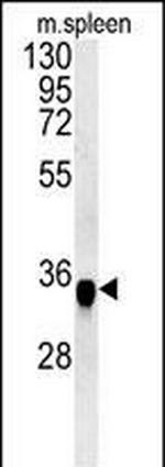 FAM49A Antibody in Western Blot (WB)