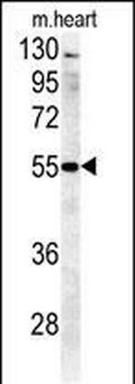 B4GALT5 Polyclonal Antibody