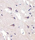 FADS2 Polyclonal Antibody