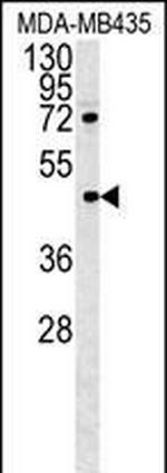PYHIN1 Antibody in Western Blot (WB)
