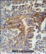 ARMC5 Polyclonal Antibody