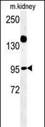 ARMC5 Antibody in Western Blot (WB)