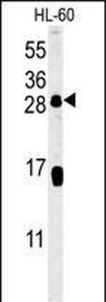 CD69 Antibody in Western Blot (WB)