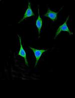 Pancreatic Amylase Polyclonal Antibody