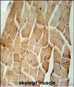 CRLS1 Polyclonal Antibody