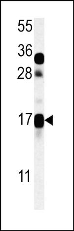 TRAG3 Antibody in Western Blot (WB)