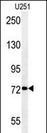 DEPDC1 Antibody in Western Blot (WB)