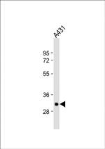Tryptase Polyclonal Antibody